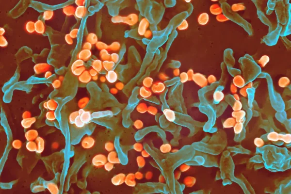 Major Health Stories Across Nigeria (March 2025 Edition)