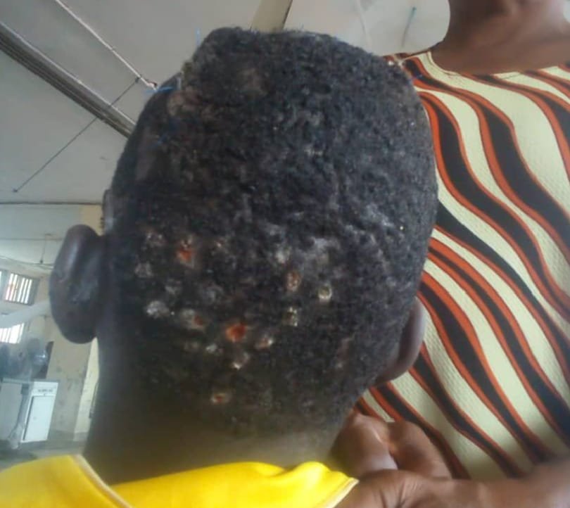 Lawyer petitions police over brutal attack on client by CRSG staff, others