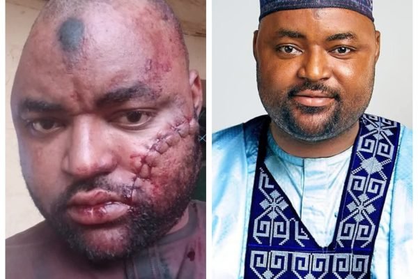 Suspected phone snatchers attack businessman in Katsina