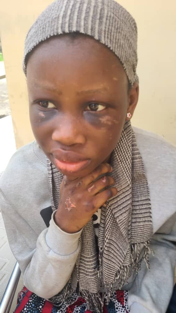 Gov Diri: Children abused for witchcraft need justice and care