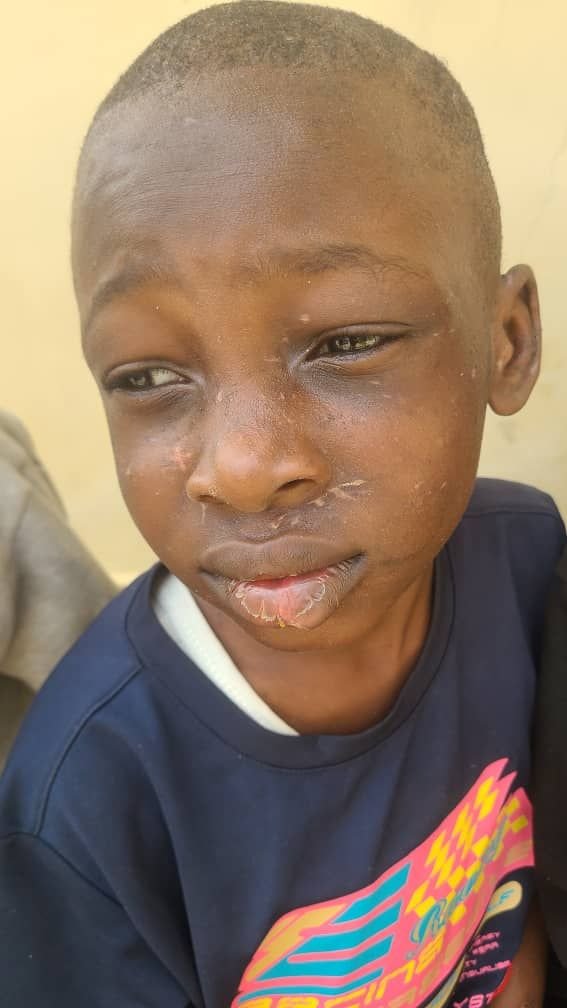 Gov Diri: Children abused for witchcraft need justice and care