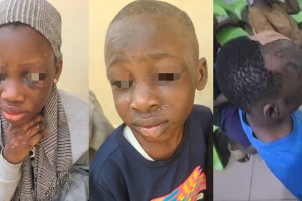 Gov Diri: Children abused for witchcraft need justice and care