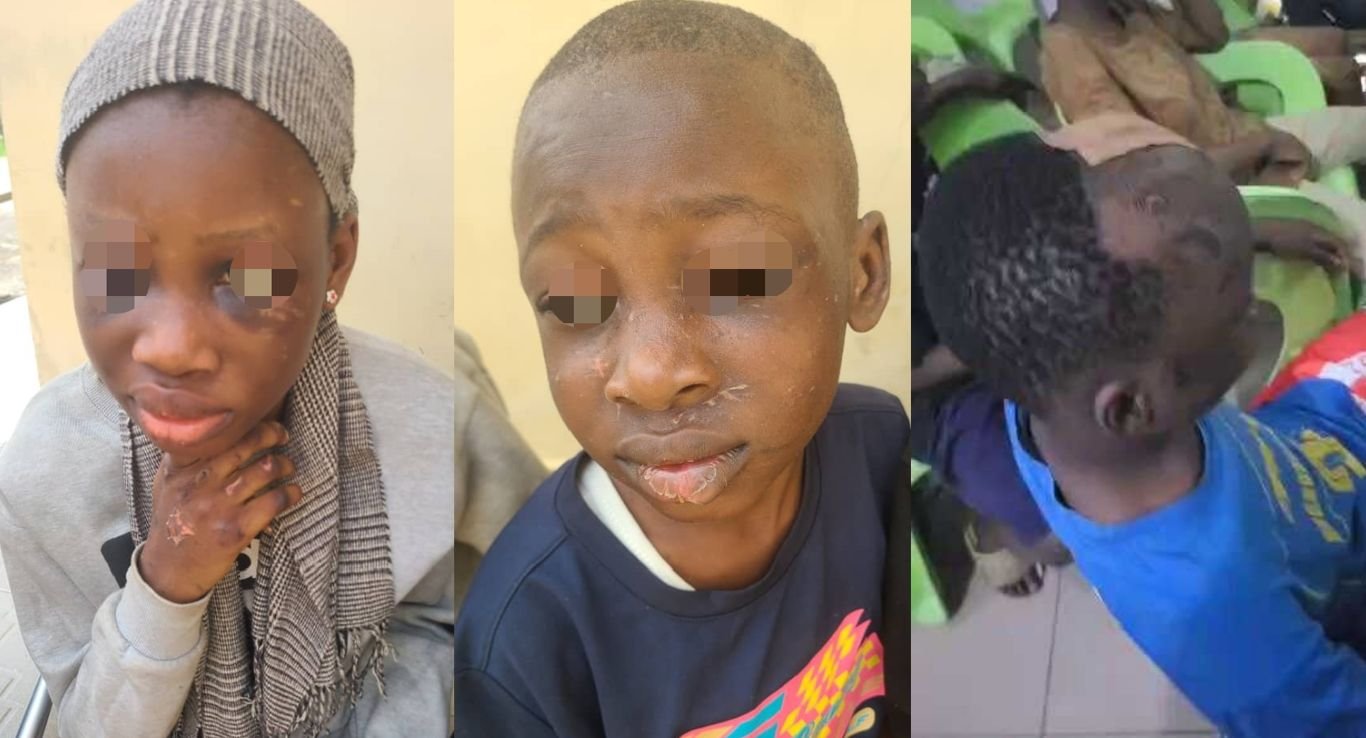 Gov Diri: Children abused for witchcraft need justice and care