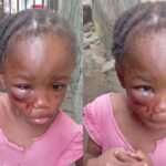 Police arrest woman for allegedly brutalising 5-year-old niece in Calabar