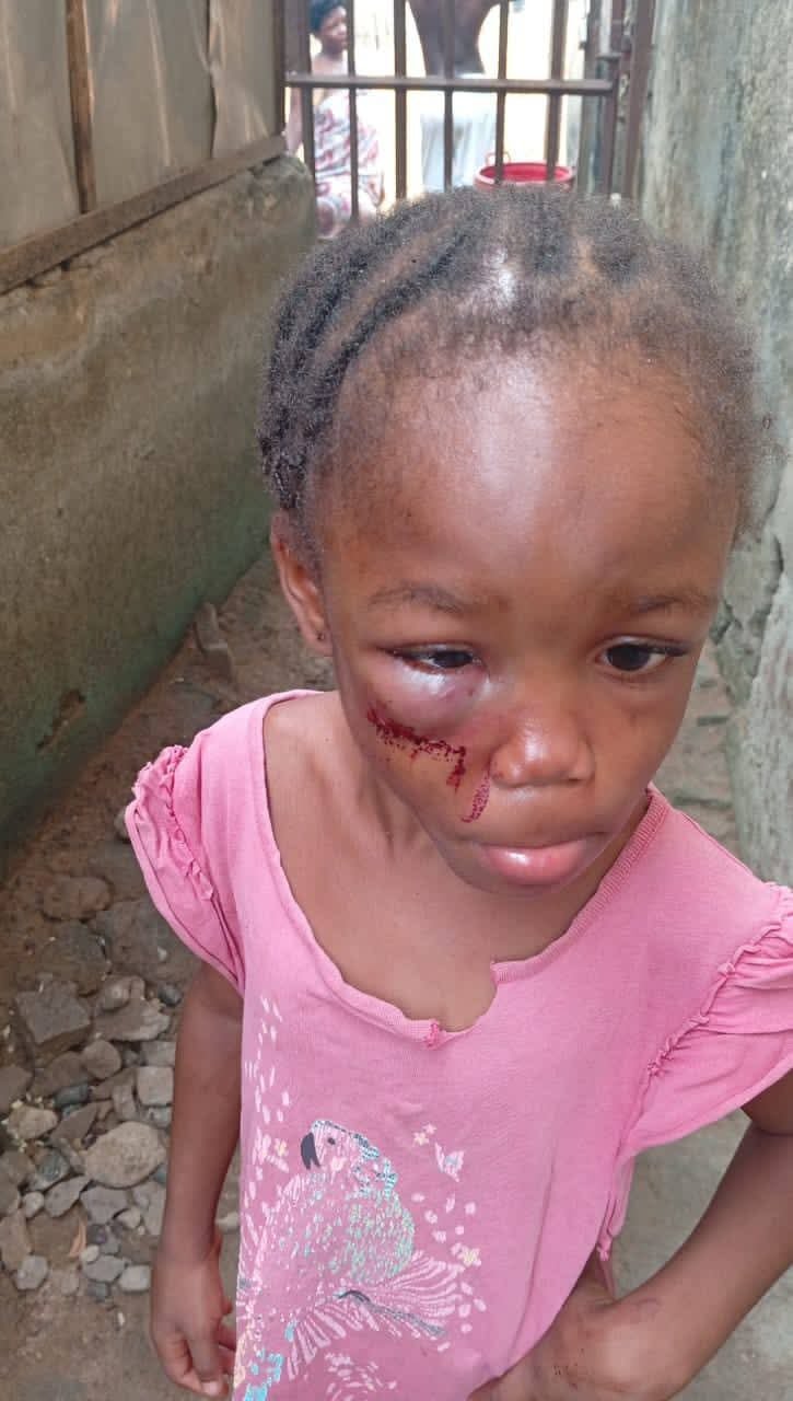 Police arrest female pastor for allegedly brutalising 5-year-old niece in Calabar