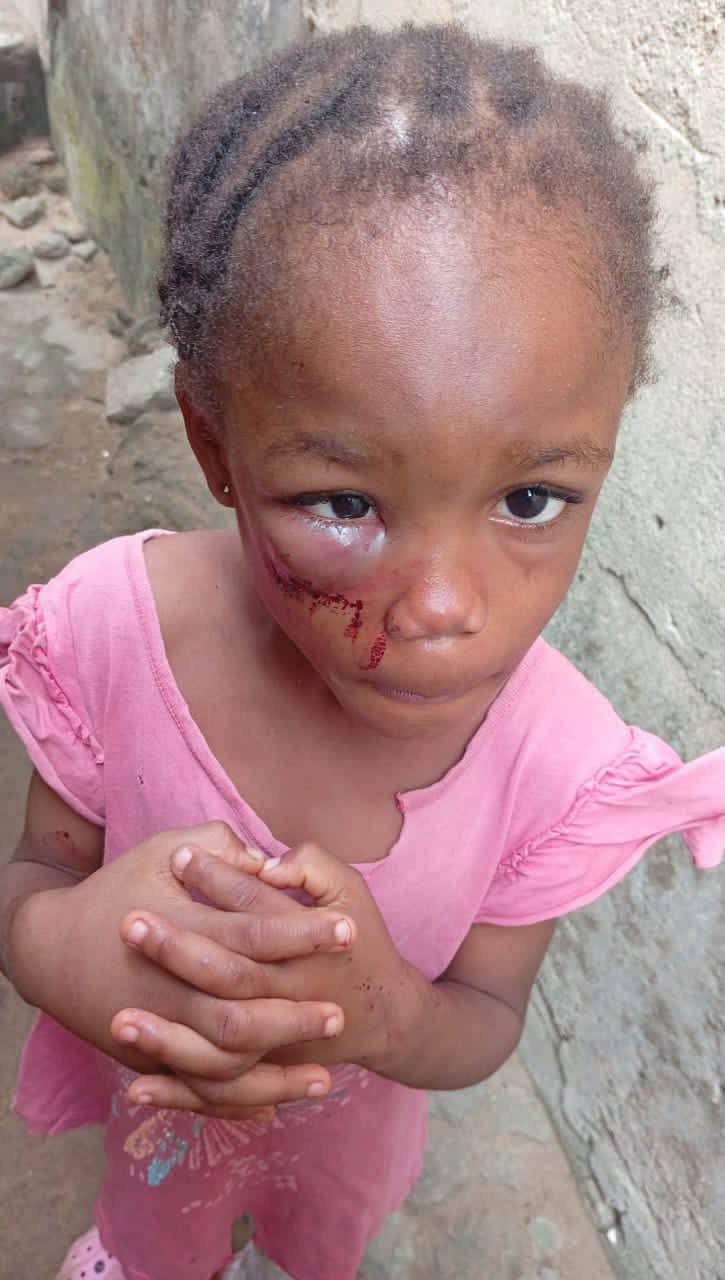 Police arrest female pastor for allegedly brutalising 5-year-old niece in Calabar