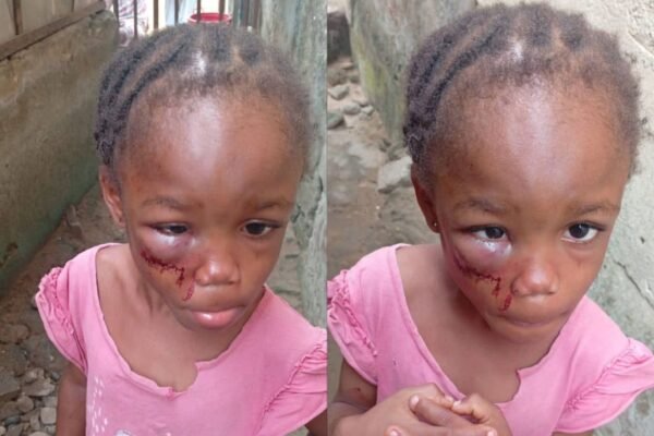 Police arrest woman for allegedly brutalising 5-year-old niece in Calabar
