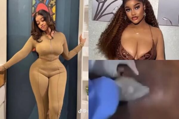 Nigerian lady dies after second BBL