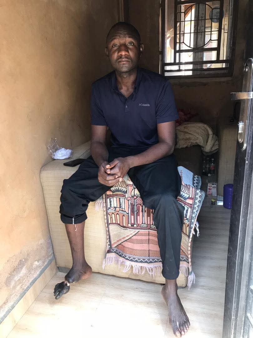 Nigerian soldier's grievous foot injury sparks sacrifice debate